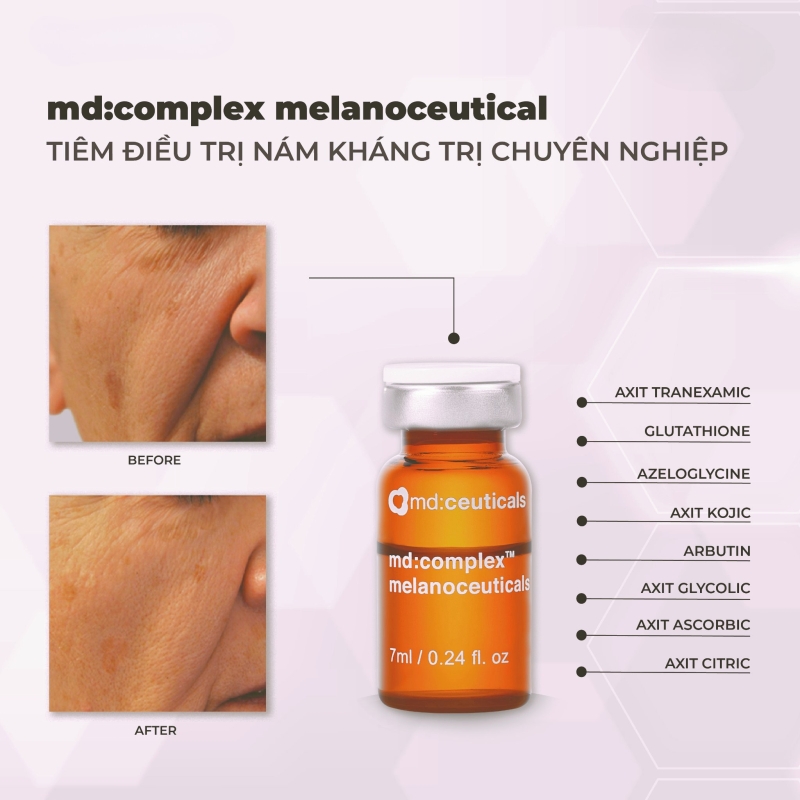 Md:ceuticals Complex Melanoceuticals _ Tinh chất meso trị nám tàn nhang và dưỡng trắng da