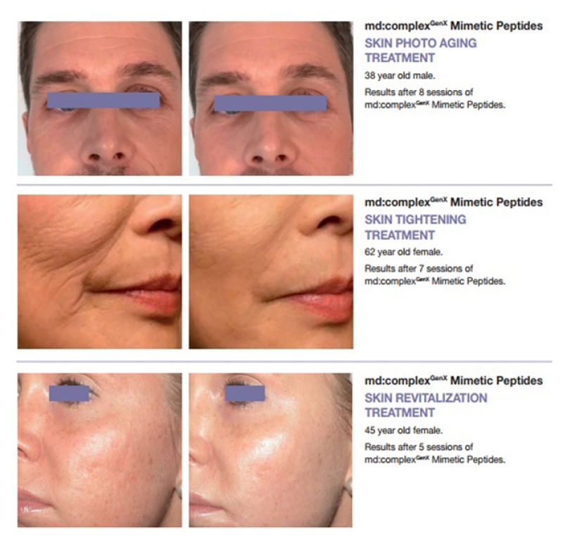 Md:ceuticals Md Complex Genx Mimetic Peptides & Growth Factor 